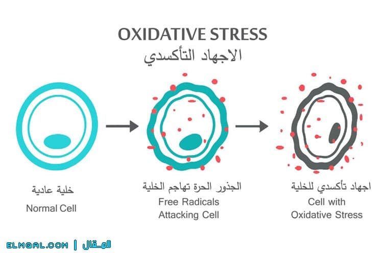 الاجهاد التأكسدي الذي تسببه الجذور الحرة Oxidative stress