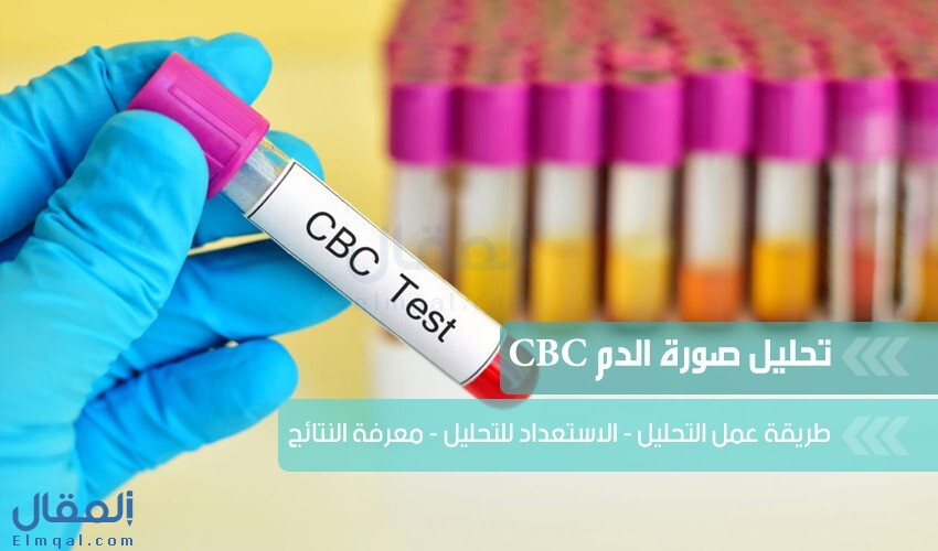 تحليل صورة دم كاملة CBC