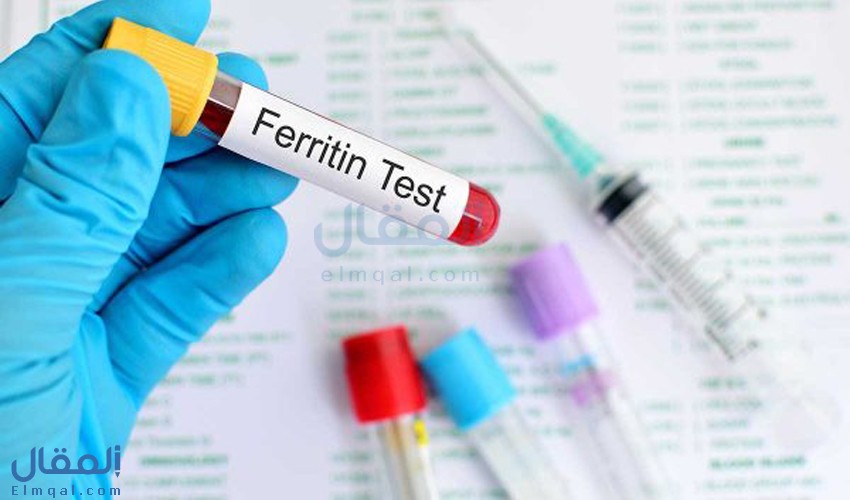 تحليل الفيريتين طريقة إجراء الاختبار وشرح نتائجه وأسباب ارتفاعه وانخفاضه