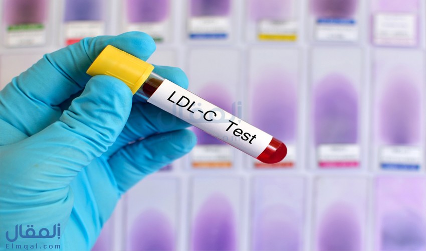 تحليل الكوليسترول الضار LDL ومتى يطلبه الطبيب؟ ومخاطره