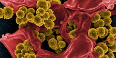 معلومات يجب معرفتها عن بكتيريا موجودة عند أغلب الناس كقنبلة موقوتة