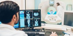 الفرق بين التصوير بالرنين المغناطيسي MRI والأشعة السينية X-Ray