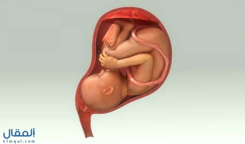 أوضاع المشيمة 5 خلال الحمل؛ ما هو الوضع الطبيعي؟ ومضاعفات تشوهات المشيمة
